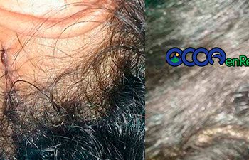 Joven-herida-Liceo-Naranjal