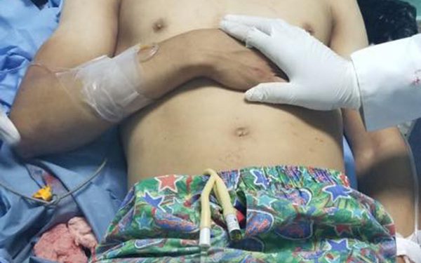 joven herido