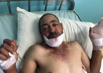 hombre herido por haitinao