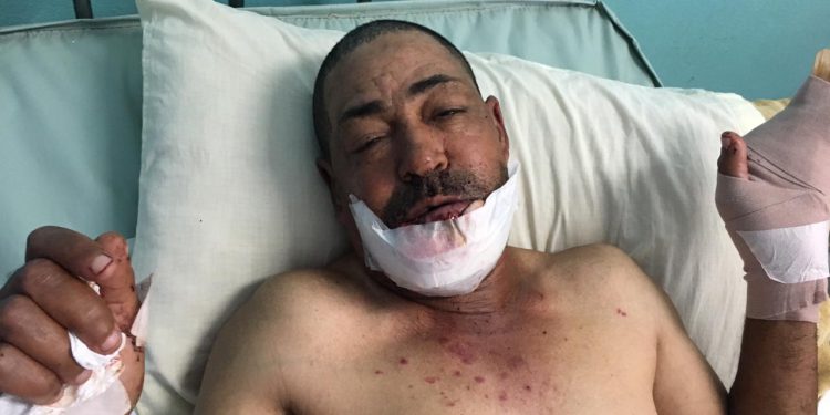 hombre herido por haitinao