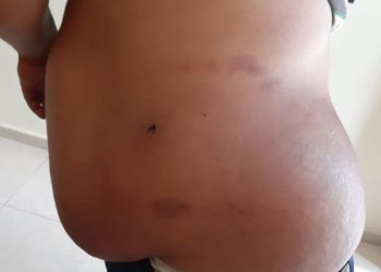 herido bala por bienvoere