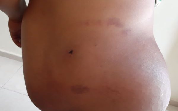 herido bala por bienvoere