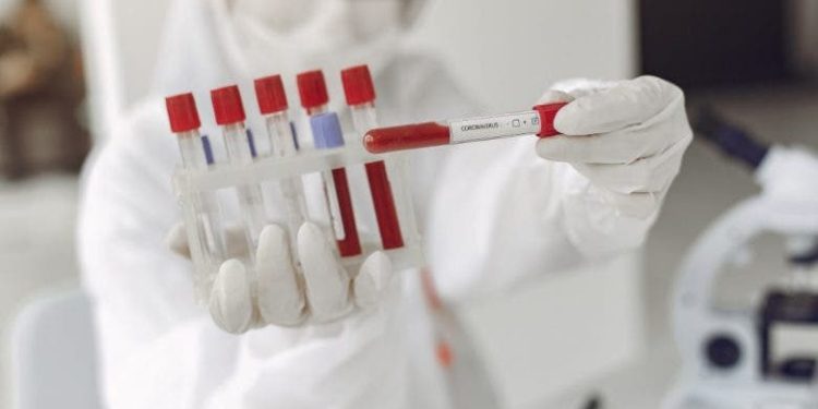 Casos coronavirus aumentan a 25,778,  fallecidos suben a 655; Ocoa sigue en 48