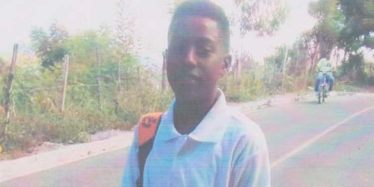 Familia pide ayuda para operar joven con obstrucción nasal