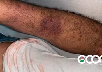 Derechos Humanos investiga si muerte de joven fue por brutalidad policial o por problemas de salud