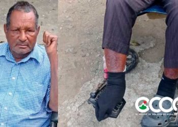 INDRHI cancela ocoeño con 20 años de servicio y siete postrado en silla de ruedas