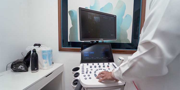 SonoScape P20 y Ex5 equipos utilizados para la campaña “Tocarte las mamas es vida” de la Dra. Tania Medina