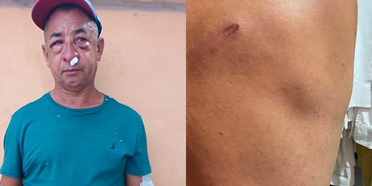 Policía apresa jóvenes acusados de herir con armas blanca a reconocido chofer