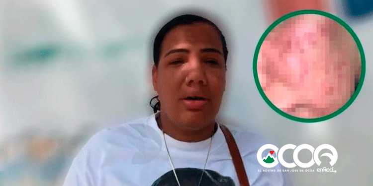 Mujer teme por su vida tras juez dejar en libertad a su agresor