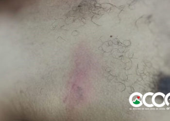 Comisión Derechos Humano denuncia muerte de joven tras ser «golpeado por la Policía» en Ocoa