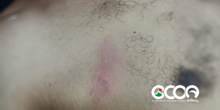 Comisión Derechos Humano denuncia muerte de joven tras ser «golpeado por la Policía» en Ocoa