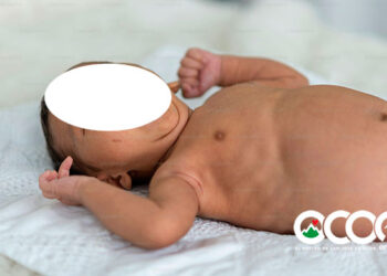 Un bebe de seis meses es violado sexualmente supuestamente por su padre haitiano en La Ciénaga