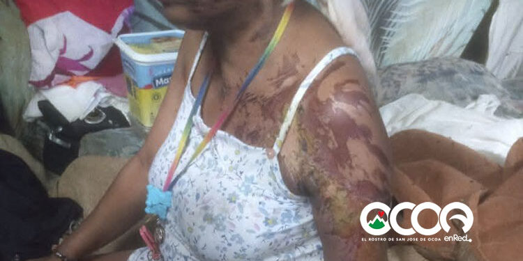 Familiares piden justicia por pariente quemada con aceite en Parra