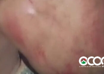 VIDEO | Familiares  denuncian presunto maltrato policial contra familiar en Naranjal Abajo