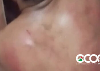 Policía aclara incidente en el Naranjal Abajo, hombre denunció agresión había golpeado menor de 11 años