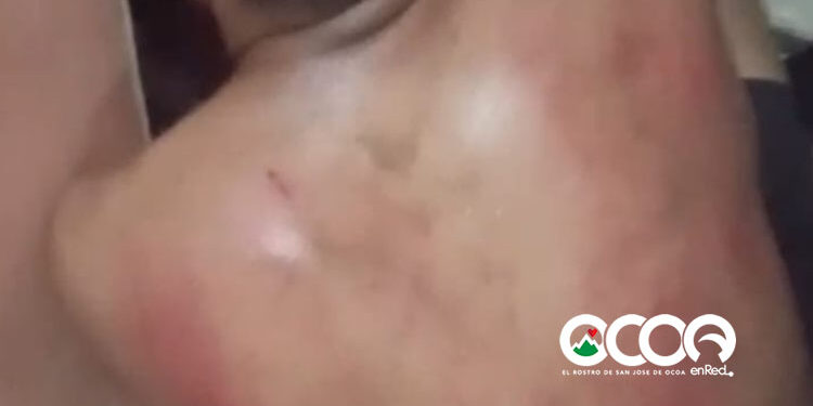 Policía aclara incidente en el Naranjal Abajo, hombre denunció agresión había golpeado menor de 11 años