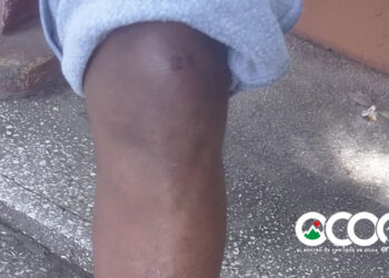 Dos policías municipales destituidos por maltrato a persona con condiciones especiales