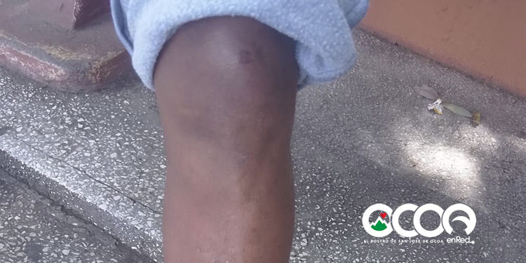 Dos policías municipales destituidos por maltrato a persona con condiciones especiales