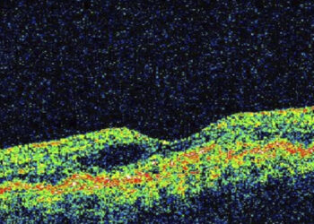 Academia de Ciencias proyectará video sobre enfermedades maculares